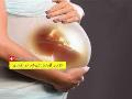 آزمایش تیروئید در دوران بارداری