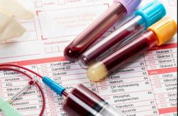آزمایش گاز خون چیست و برای چه کاری استفاده می‌شود؟