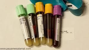 اهمیت اندازه گیری آمونیاک خون