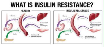 آزمایش های تشخیص مقاومت به انسولین