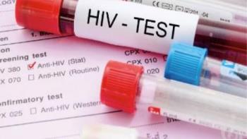 انواع آزمایش های تشخیصی برای عفونت HIV