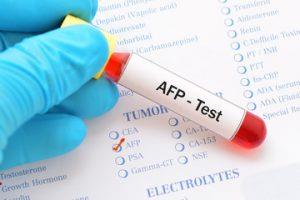 آلفافیتوپروتئین ( AFP) مارکر تشخیص سرطان کبد