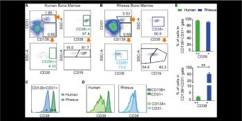 نقش CD138 ، CD38 و CD19 در تشخیص بدخیمی پلاسما سل