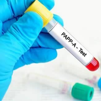 نحوه فالوآپ زنان باردار با پروتئین پلاسمایی مرتبط با بارداری (PAPP-A) پایین