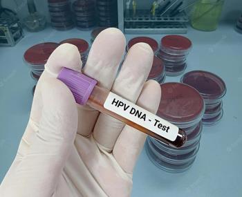آزمایش HPV چگونه انجام می شود؟
