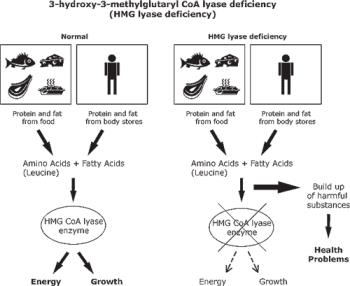 اختلالات متابولیک اسیدهای اُرگانیک: HMG-CoA Lyase deficiency