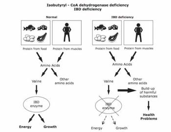 اختلالات متابولیک اسیدهای اُرگانیک: Isobutyryl-CoA dehydrogenase deficiency