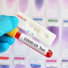 مرور تستهای تشخیصی ایمونولوژیک سریع برای کووید-19 بر مبنای توصیه های سازمان جهانی بهداشت